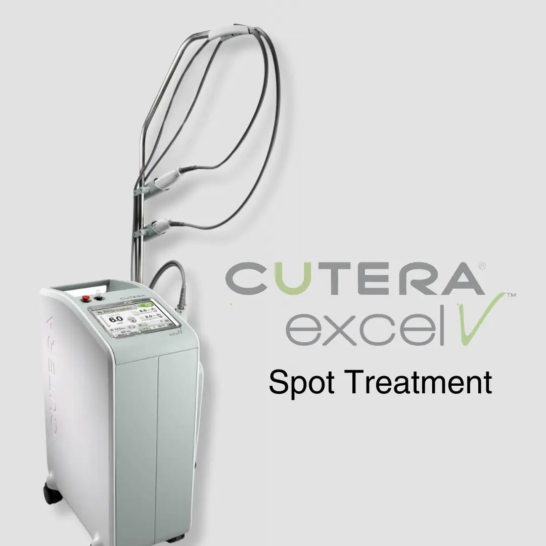 Excel V | Cutera | Spot Treatment | Beautiful Aesthetics