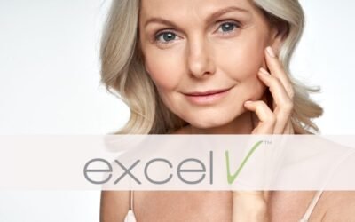 Revolutionize Your Skin: Cutera Excel V Laser – The Ultimate Remedy for Vascular Skin Concerns